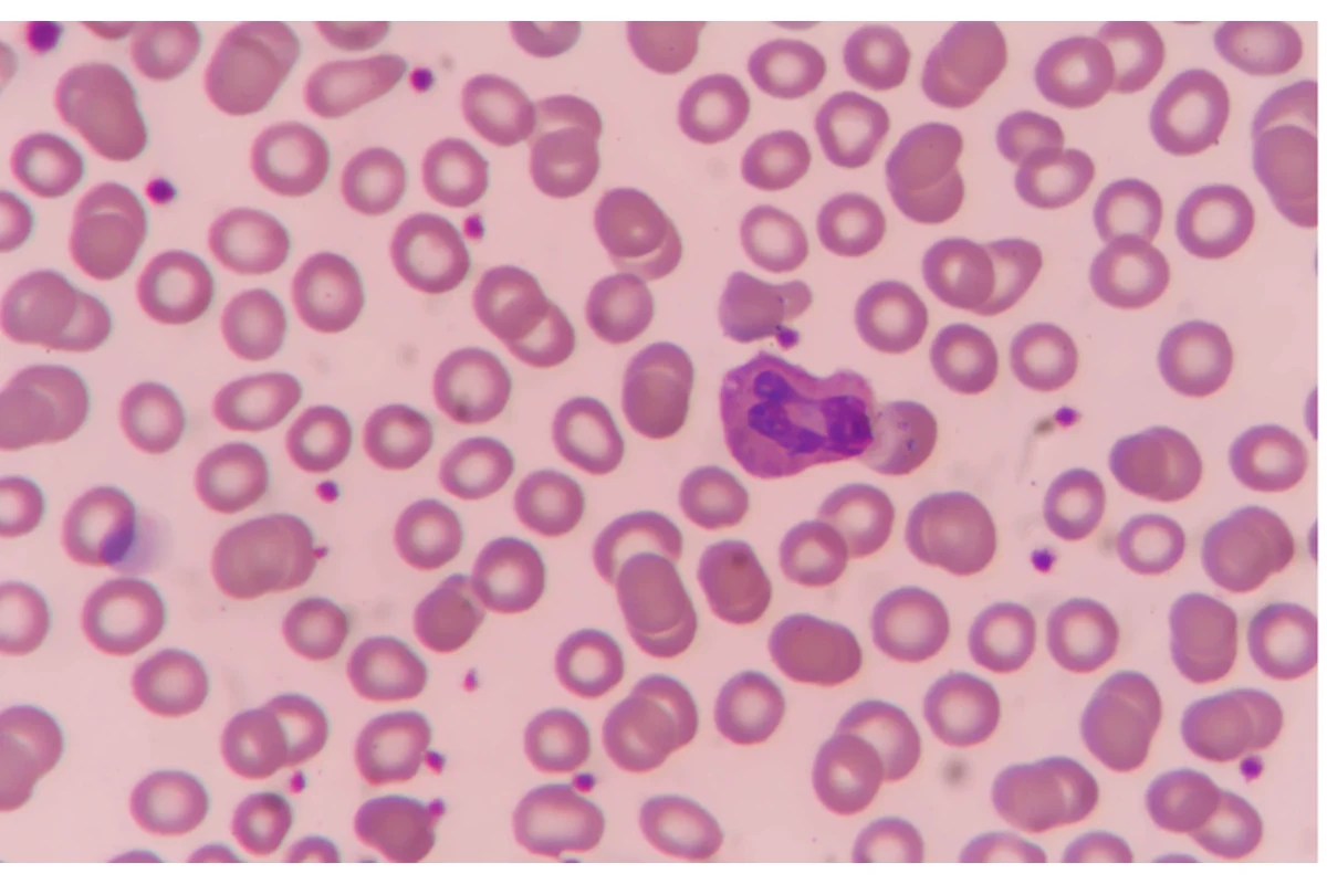Imagen principal: Anemia en animales de compañía