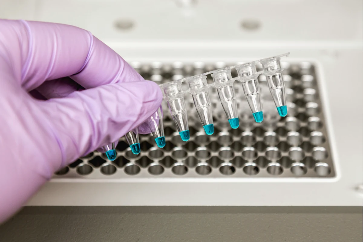 Imagen principal: Tipos de PCR y sus aplicaciones