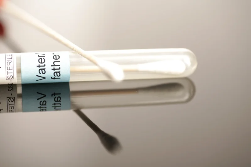 Frotis bucal con hisopo para test de paternidad